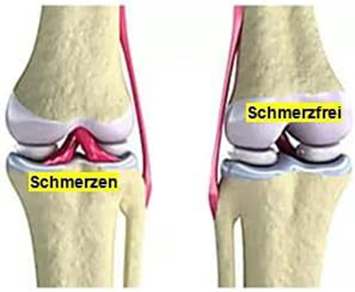 Weihrauch Knorpel & Gelenke Komplex + Glucosamin & Chondroitin 120 Pulver Kapseln